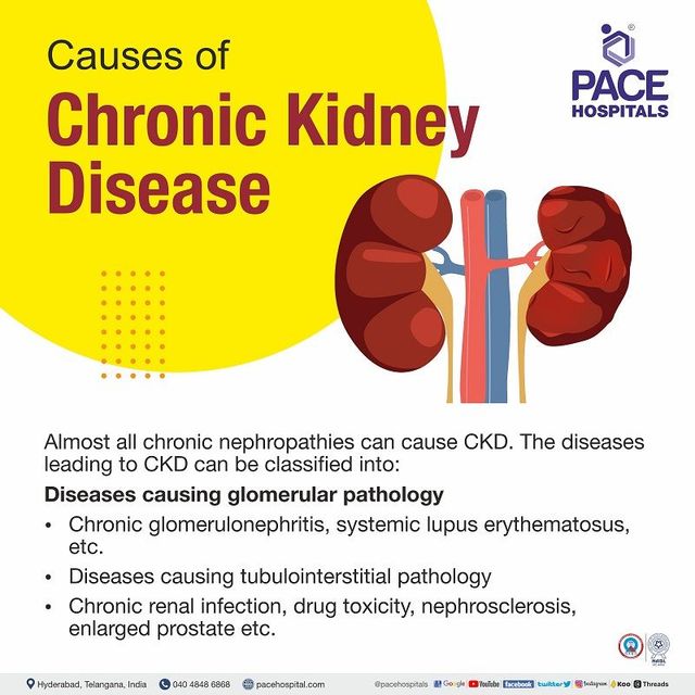 Chronic Kidney Disease Symptoms, Stages, Causes, Risk, 40% OFF
